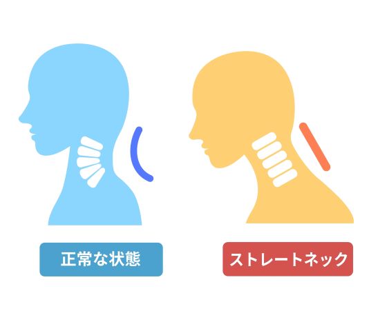 ストレートネックのときに選びたい枕とは？