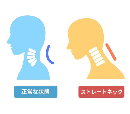 ストレートネックのときに選びたい枕とは？